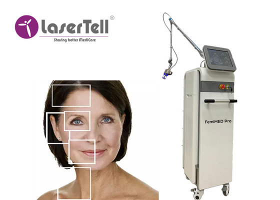 Máquina fracionária Vaginal Treatment Rejuvenation do laser do CO2 portátil de Lasertell
