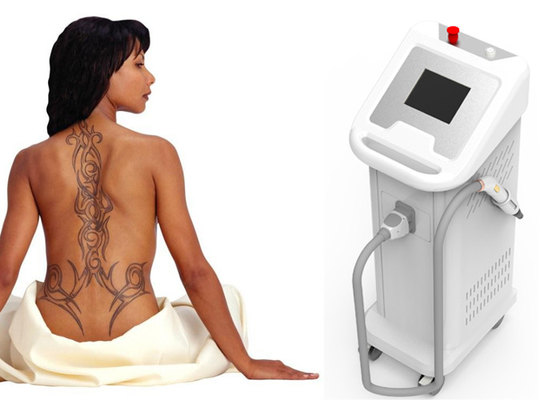 Dispositivo 1 da remoção da tatuagem do laser do ND Yag da clínica - densidade de energia 1000mJ ISO13485 provada