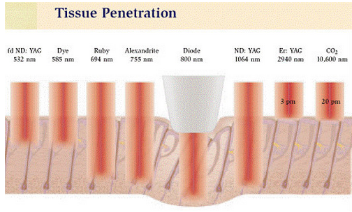 Laser Multifunction do Nd Yag da máquina 1064 nanômetro da beleza das mulheres, equipamentos da remoção do laser da tatuagem