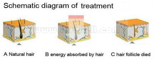 Equipamento da beleza das mulheres SHR IPL para pulsos do rejuvenescimento da pele da remoção do cabelo únicos