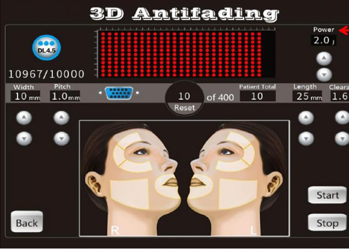 20000 cartuchos da máquina 8 do restauro dos tiros 3D Hifu com 1-11 alinham