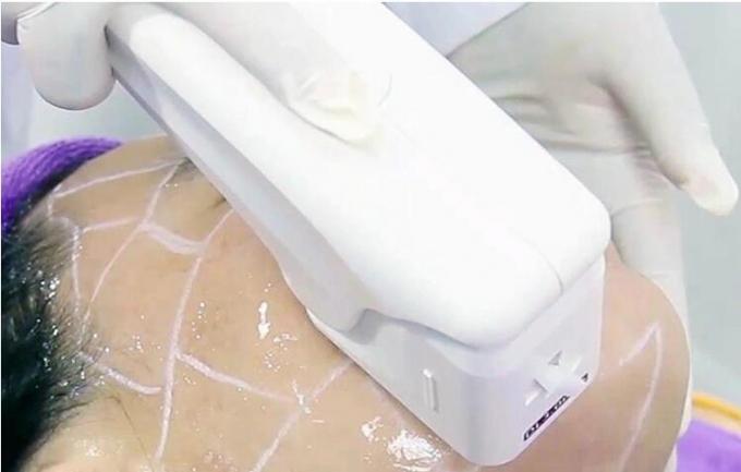 máquina da beleza de 300W Hifu cartuchos de 1.5mm - de 16mm com os 15,4 da” telas tácteis cor