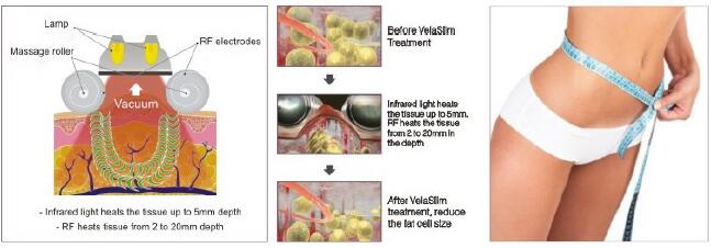 máquina V9 Velashape do emagrecimento do RF do vácuo da cavitação 40K com certificação do CE